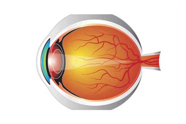 عدسی (Lens)