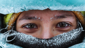 ۷ علت خستگی چشم در زمستان و راهکار علمی