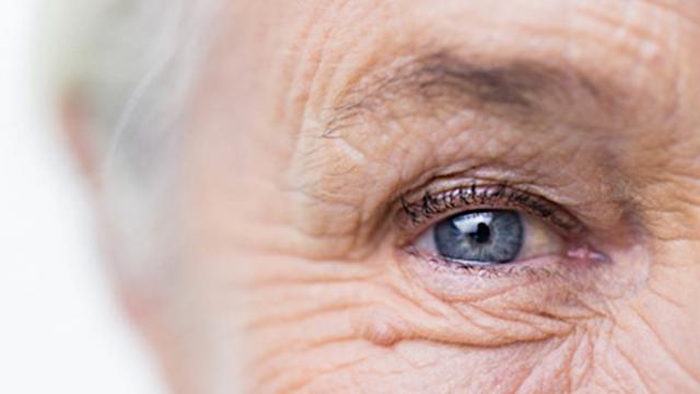 آیا ساخت قطره ای برای رفع پیر چشمی حقیقت دارد؟